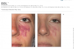 2600-033-93rA_BBL(binder)