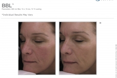 2600-033-94rA_BBL(binder)