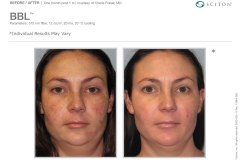 2600-035-19 Rev A B&A Photos, BBL_(binder)