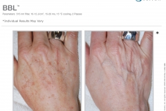 2600-036-36 Rev A B&A Photos, BBL_(binder)